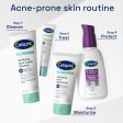 Gentle Clear Clarifying Acne Cream Cleanser Online Hot Sale