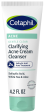 Gentle Clear Clarifying Acne Cream Cleanser Online Hot Sale